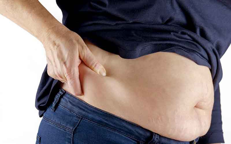 Fat around waist more important in predicting COVID-19 severity