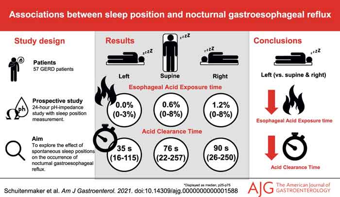 Sleep left side to shorten gastroesophageal reflux, finds study