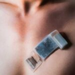 New wearable ultrasound system