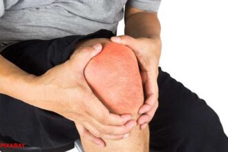 alt="knee osteoarthritis"