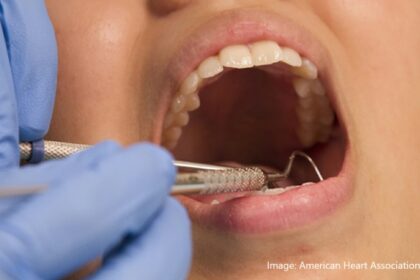 alt="Dental flossing"