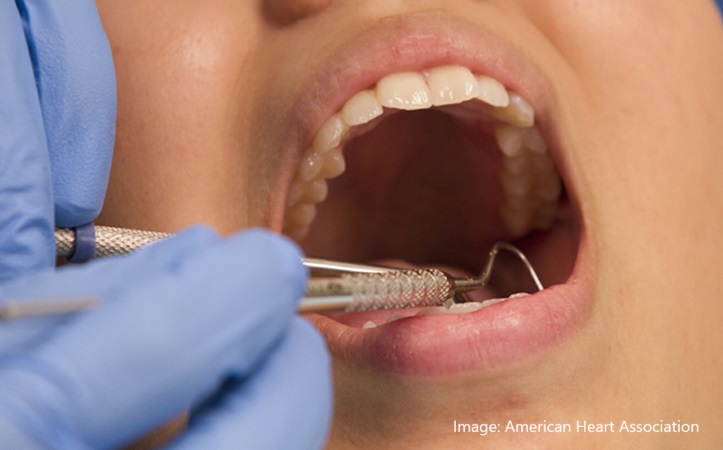 alt="Dental flossing"