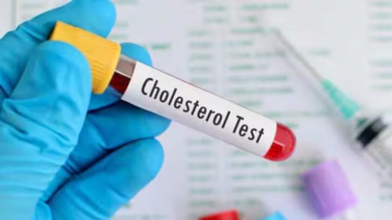 alt="LDL cholesterol and dementia risk"