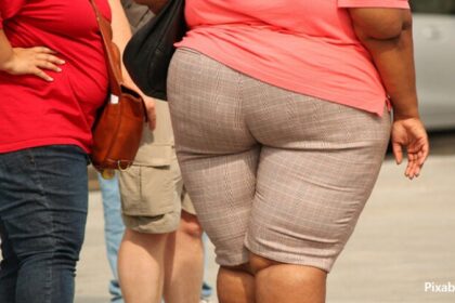 alt="severe obesity"