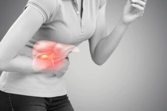 alt="fatty liver disease treatment"