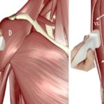alt="Muscle ultrasound may detect early prediabetes"