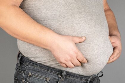 alt="obesity"