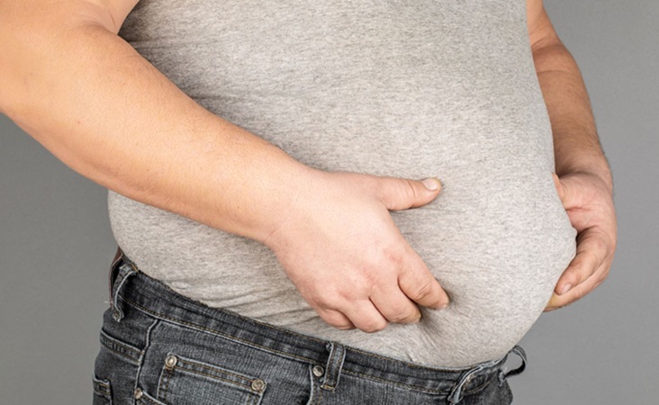 alt="obesity"
